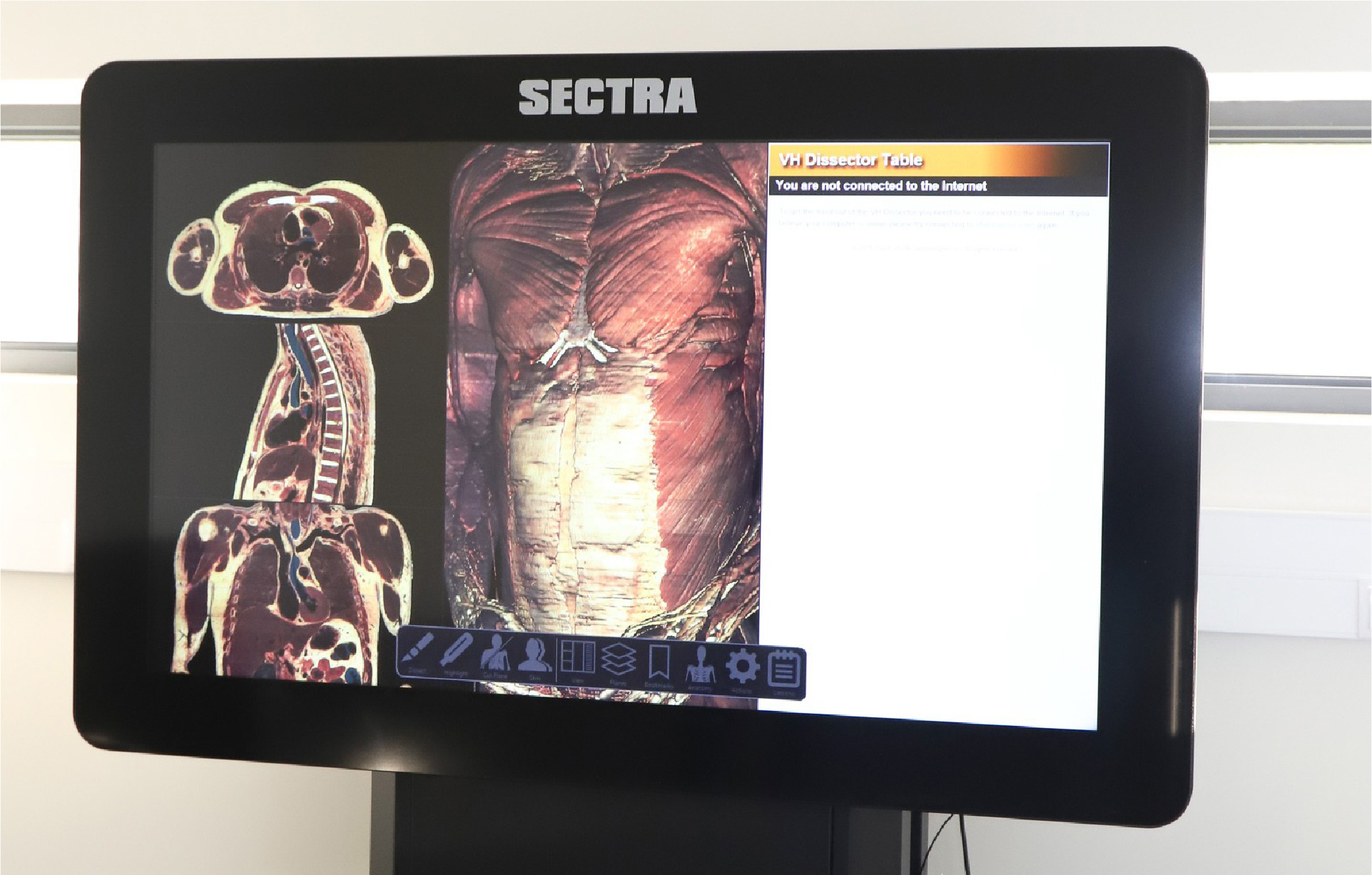 Sectra